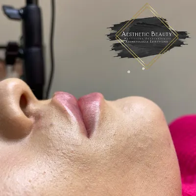 Aesthetic Beauty Magdalena Frasunkiewicz